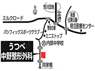 うつべ中野整形外科｜四日市市｜整形外科・リハビリ科